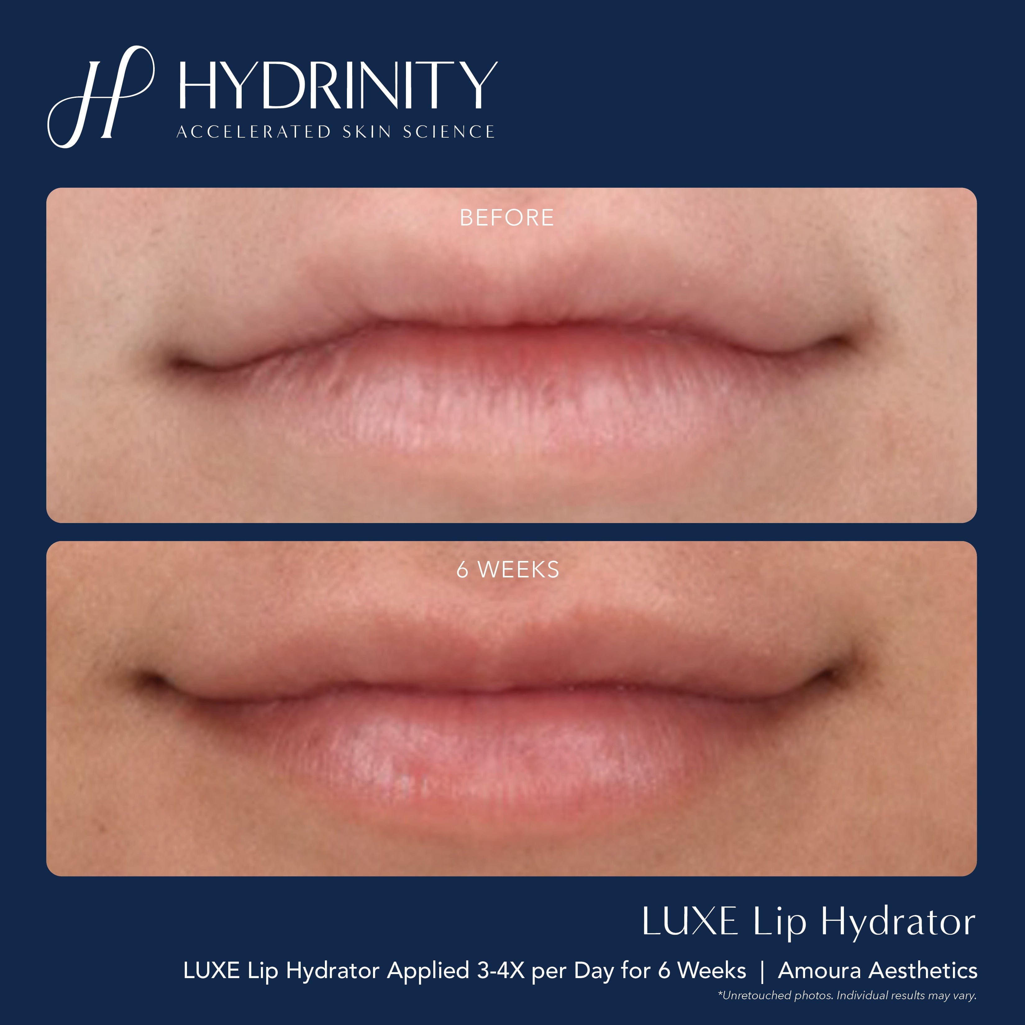 Hydrinity LUXE Lip Hydrator