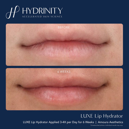 Hydrinity LUXE Lip Hydrator