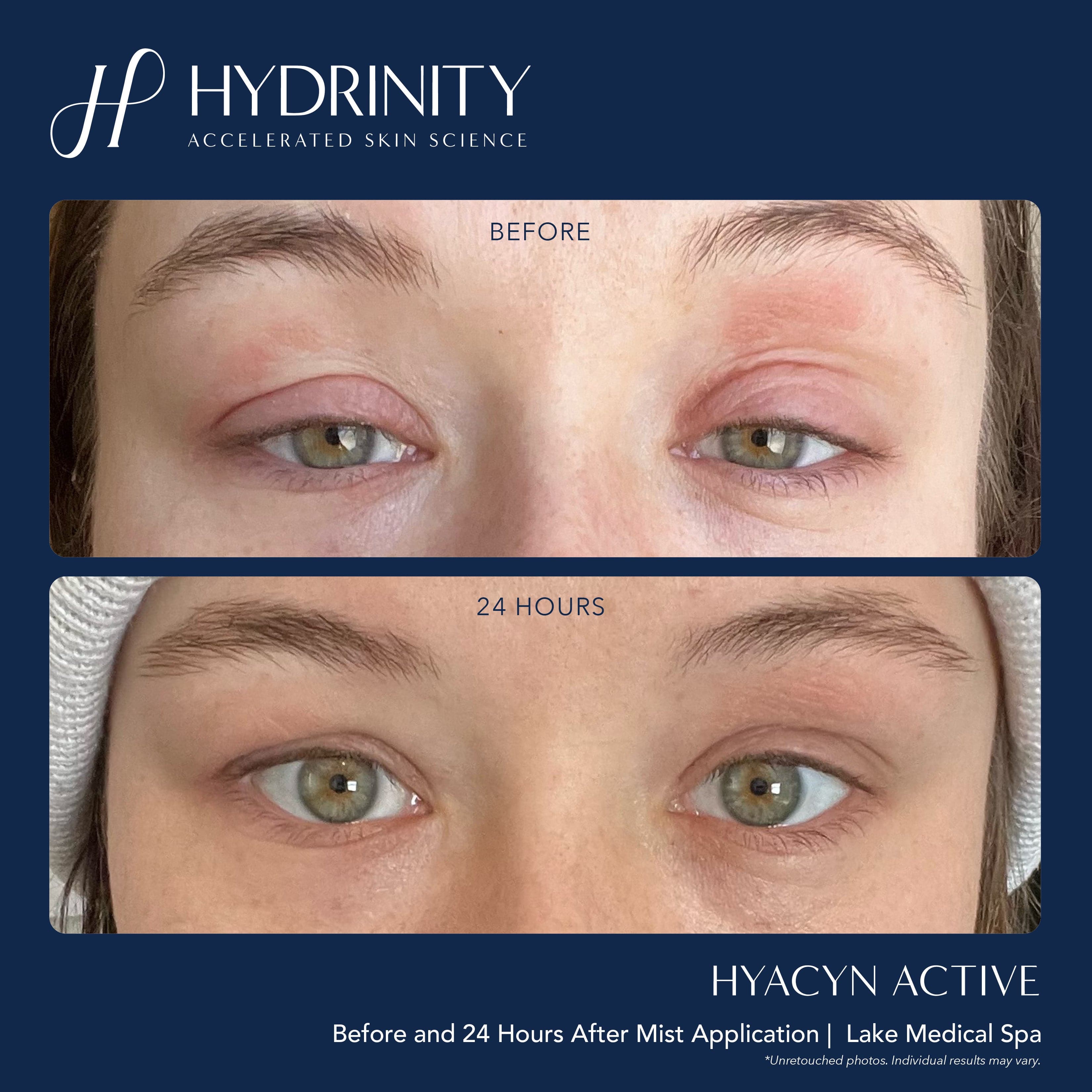 Hydrinity Hyacyn Active Purifying Mist