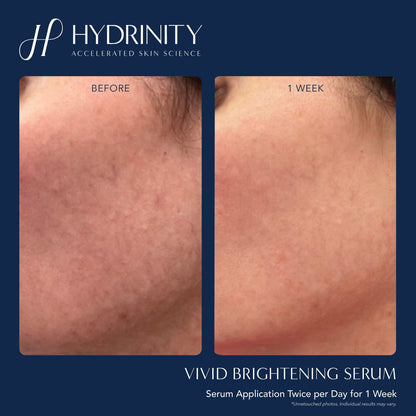 Hydrinity VIVID Brightening Serum