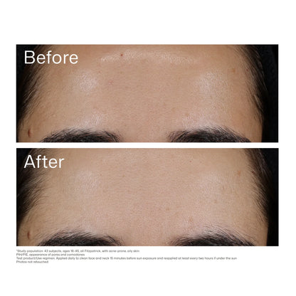EltaMD® UV Clear Blemish-Prone & Oil Balancing SPF 50  - 1.7 fl. oz. / 48 g