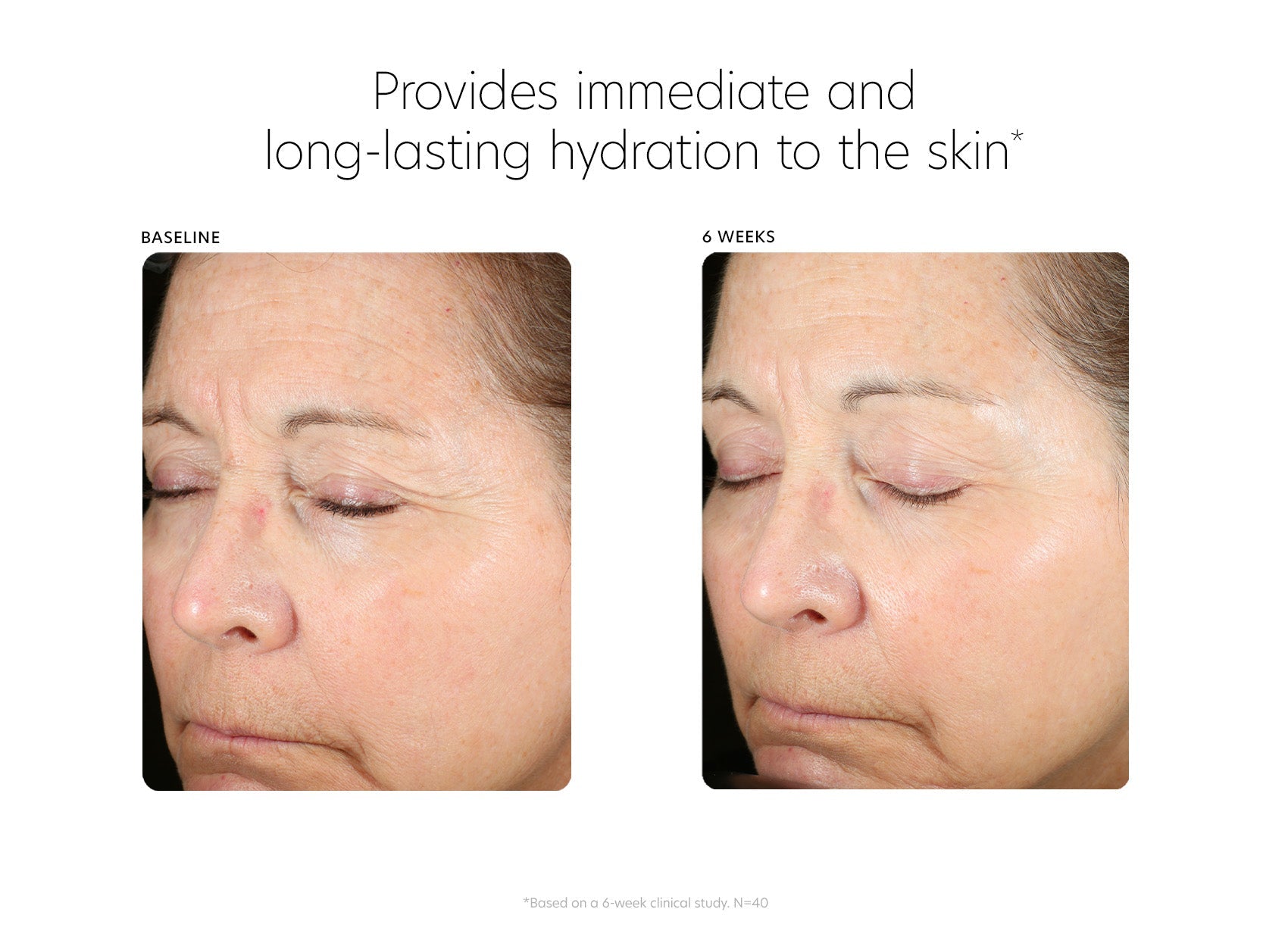 PCA Skin® Hyaluronic Acid Boosting Serum - 3fl oz