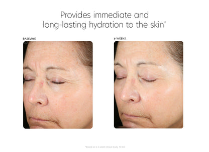 PCA Skin® Hyaluronic Acid Boosting Serum - 3fl oz
