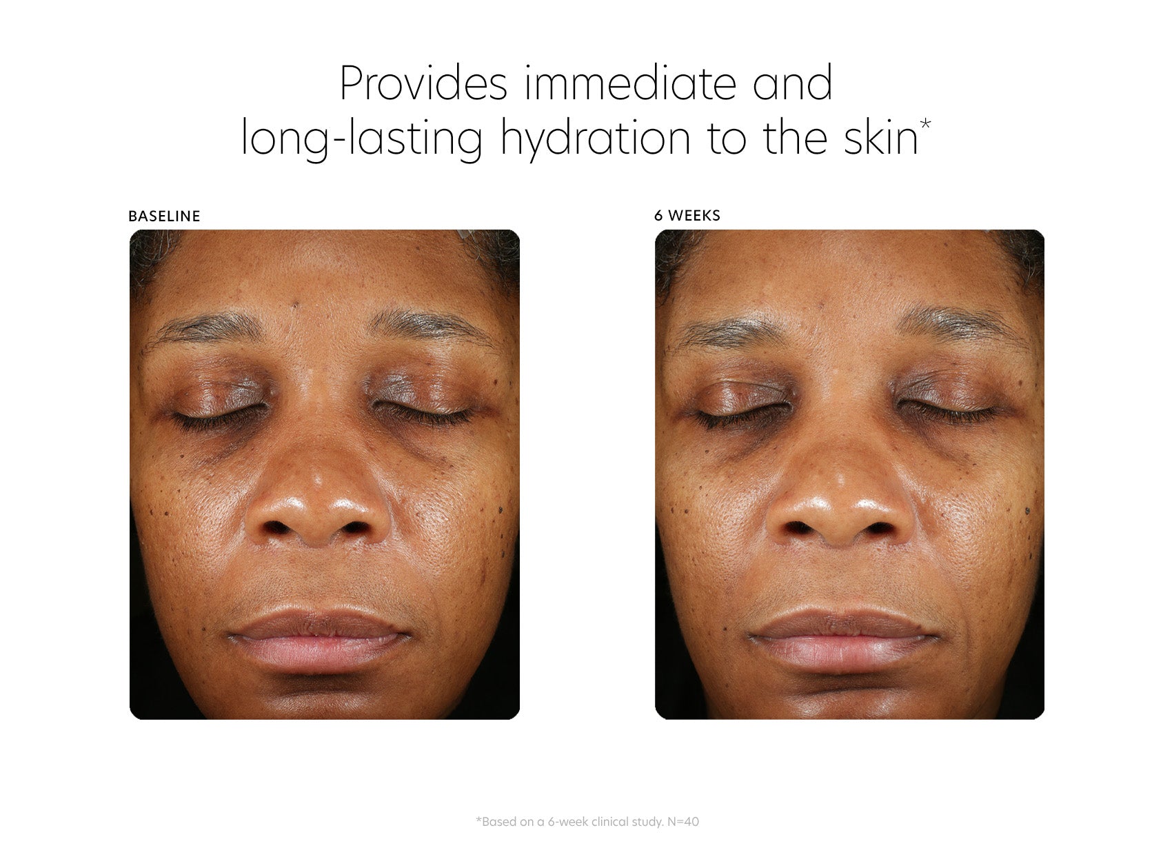PCA Skin® Hyaluronic Acid Boosting Serum - 1fl oz