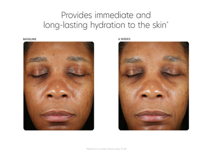 PCA Skin® Hyaluronic Acid Boosting Serum - 1fl oz