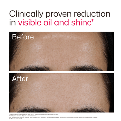 EltaMD UV Clear Acne Blemish-Prone & Oil Balancing SPF 50