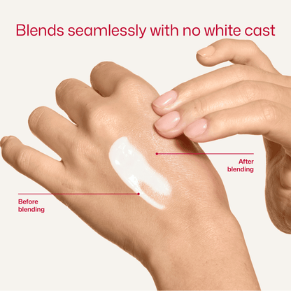 EltaMD UV Clear Acne Blemish-Prone & Oil Balancing SPF 50