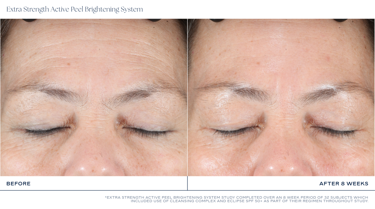 iS CLINICAL Extra Strength Active Peel Brightening System