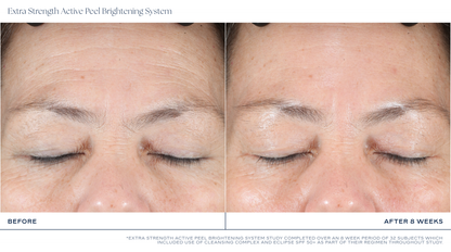iS CLINICAL Extra Strength Active Peel Brightening System