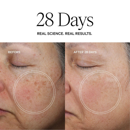 Exoceuticals Exo Face Perfection Moisturizer