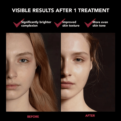 FOREO FAQ™ 201 Ultra-Lightweight Silicone RGB LED Face Mask