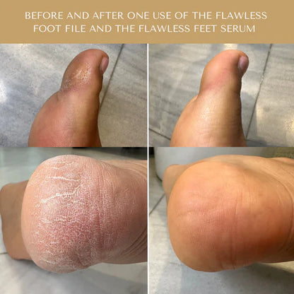 Serum Doctor Flawless Feet Serum
