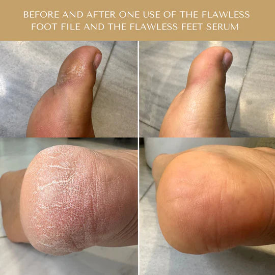 Serum Doctor Flawless Feet Serum
