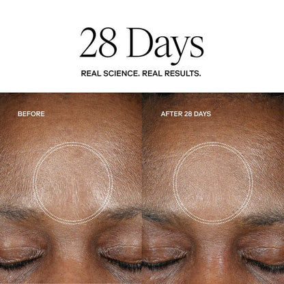 Exoceuticals H-Serum Hyaluronic Acid Treatment