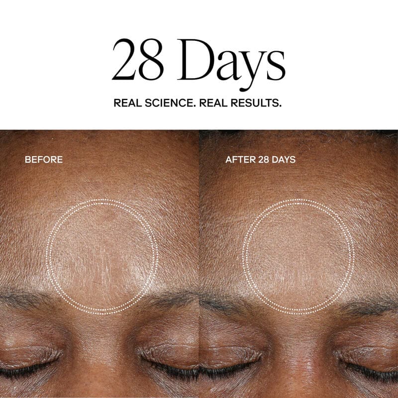 Exoceuticals H-Serum Hyaluronic Acid Treatment