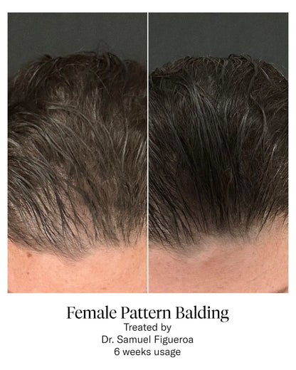 Calecim HAIR Serum
