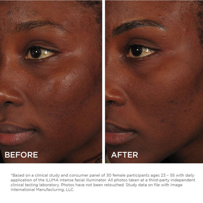 IMAGE Skincare Iluma® Intense Facial Illuminator