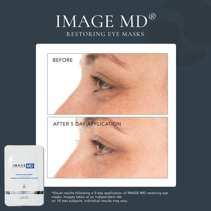 IMAGE Skincare IMAGE MD® Restoring Eye Masks