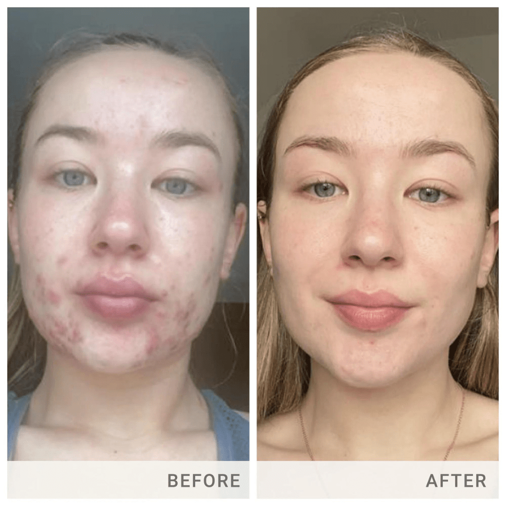 Jane Iredale Skin Accumax® Supplements