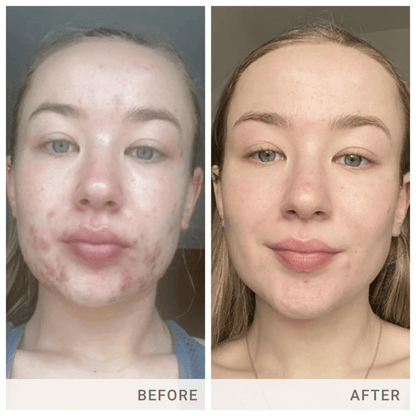 Jane Iredale Skin Accumax® Supplements