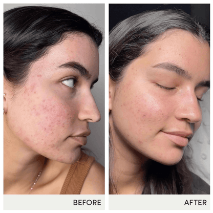Jane Iredale Skin Accumax® Supplements
