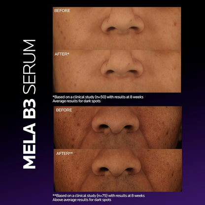 La Roche-Posay Mela B3 Dark Spot Serum