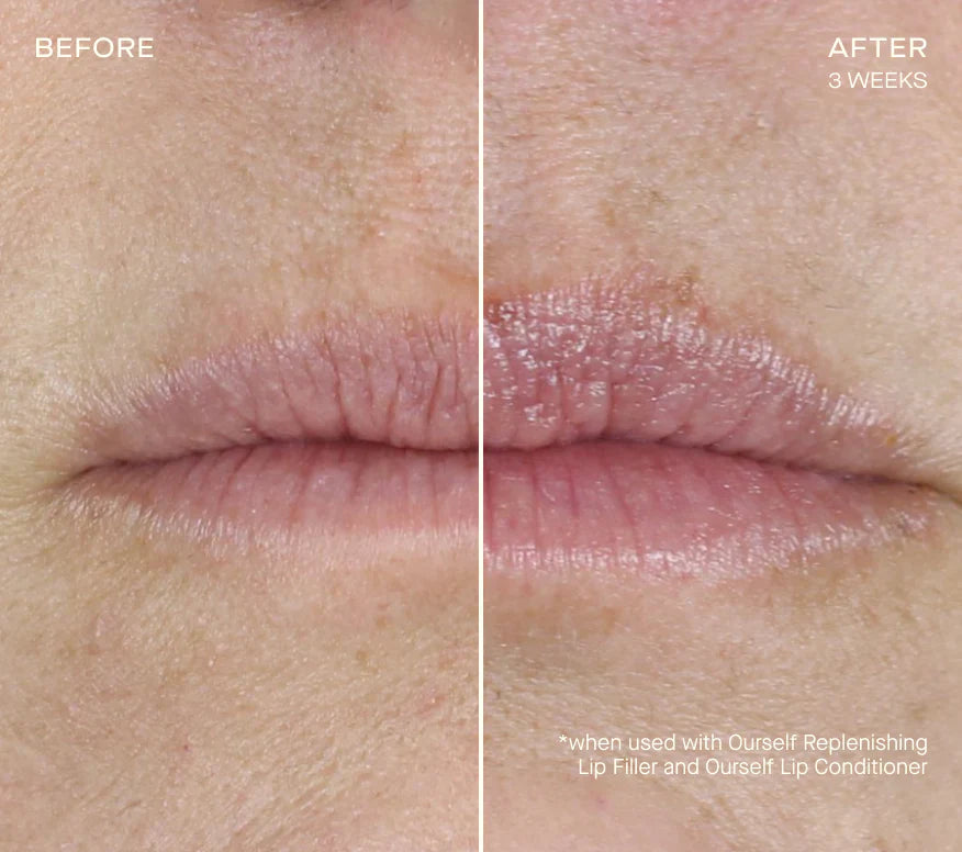 Ourself Replenishing Lip Filler