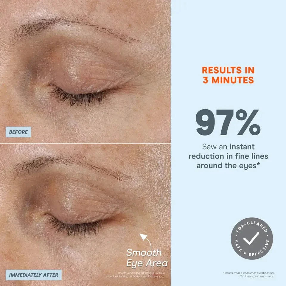 NuFACE FIX MicroWand Microcurrent Device for Eyes, Lips & Lines