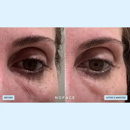 NuFACE IonPlex Hydra-Gel Power Patches