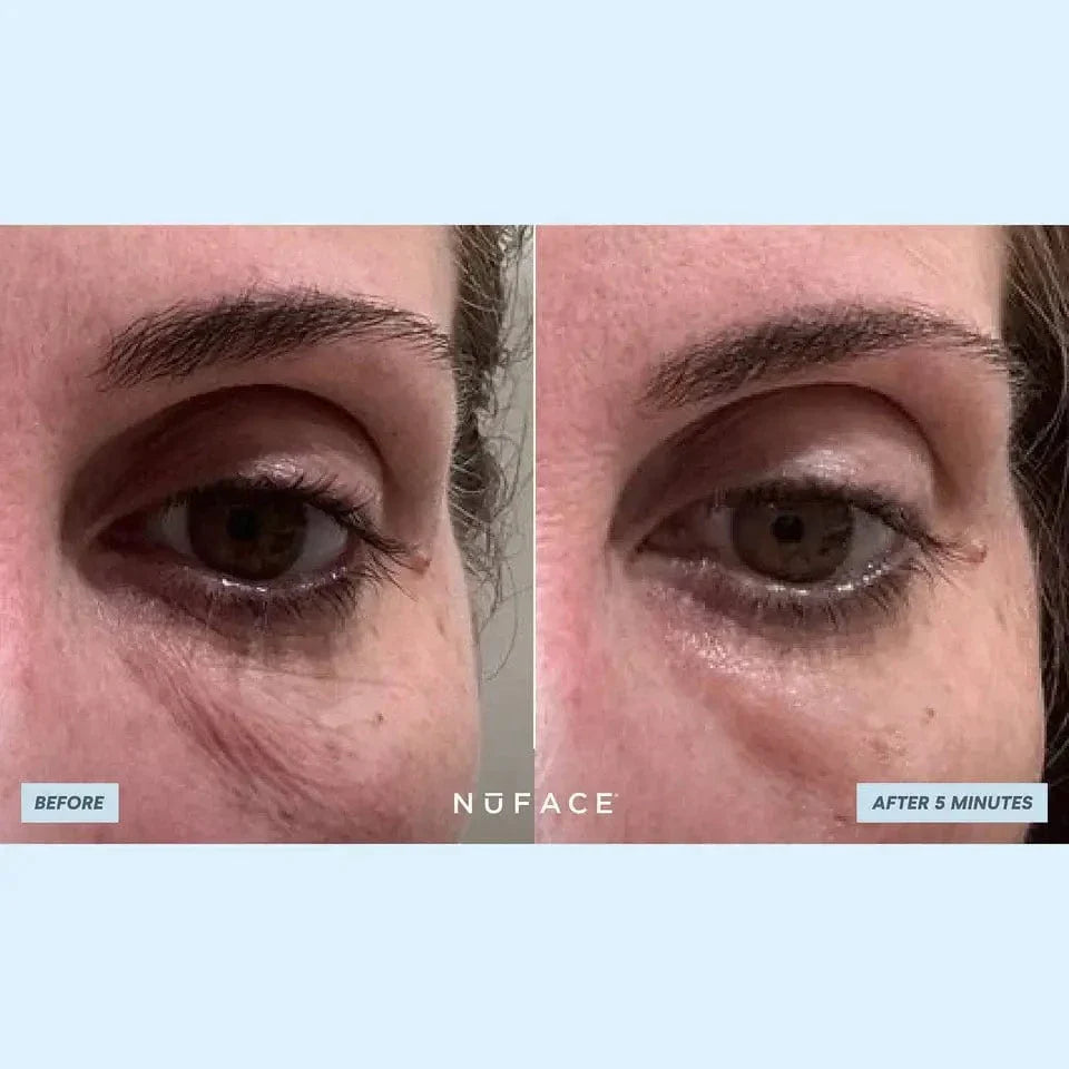 NuFACE IonPlex Hydra-Gel Power Patches