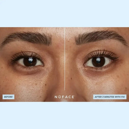 NuFACE IonPlex Hydra-Gel Power Patches