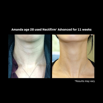 Revision Skincare Nectifirm® ADVANCED