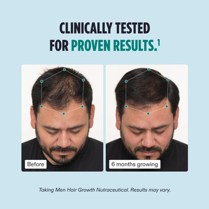Nutrafol Men's Fullest Hair Kit