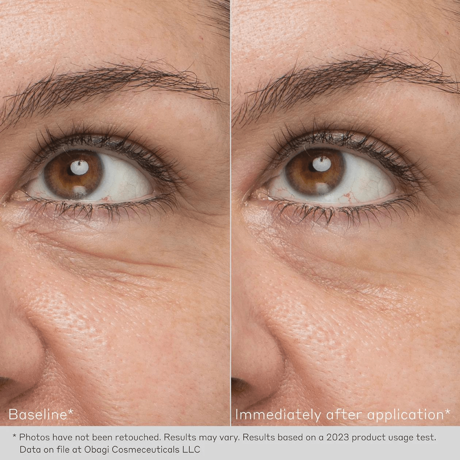 Obagi Daily Hydro-Drops Rejuvenating Eye Gel Cream