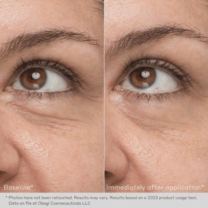 Obagi Daily Hydro-Drops Rejuvenating Eye Gel Cream