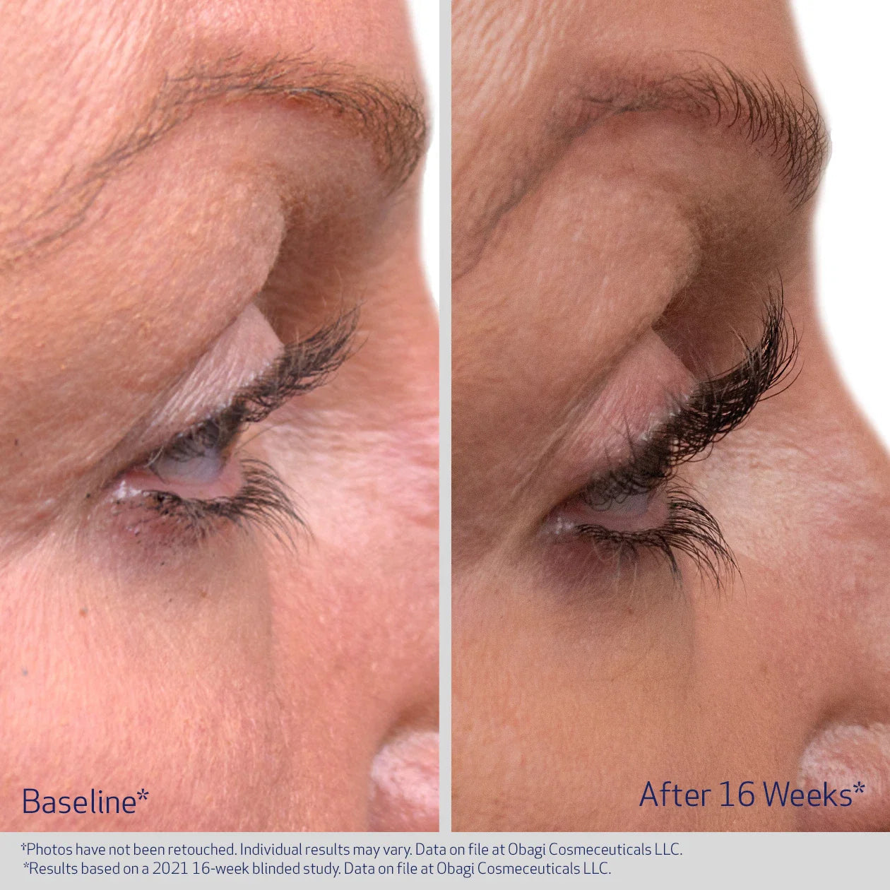Obagi® Nu-Cil™ EYELASH ENHANCING SERUM