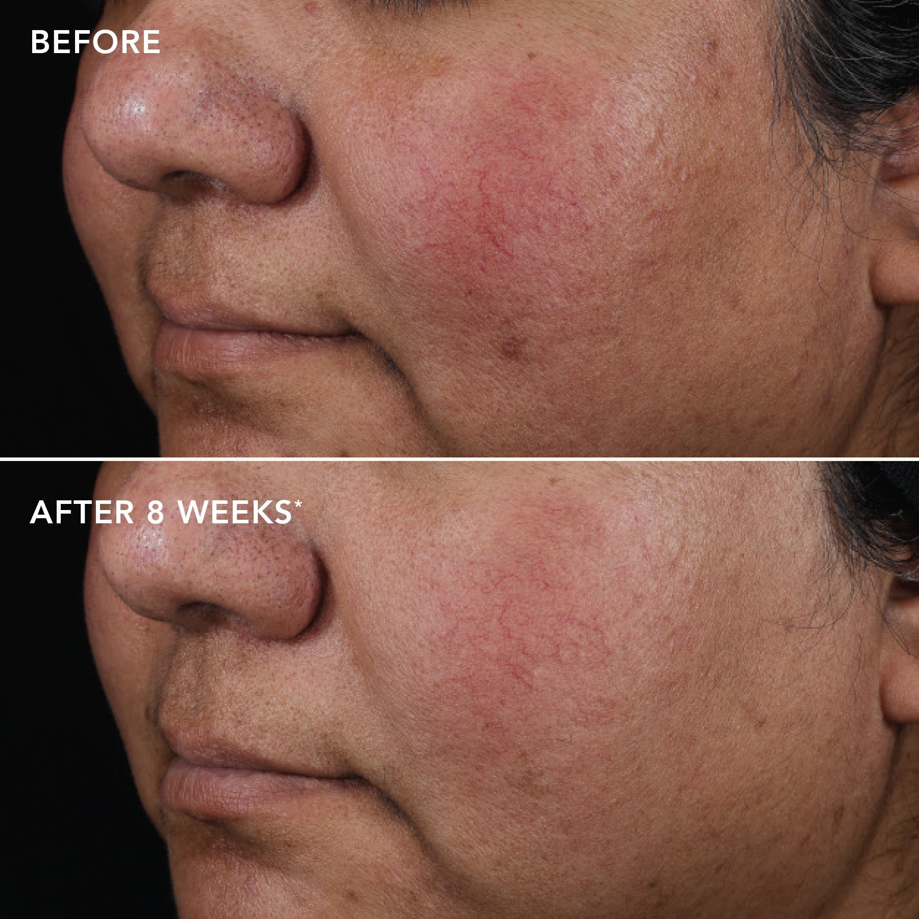 IMAGE AGELESS+ retinol pure liquid retinol 0.75% (travel size)
