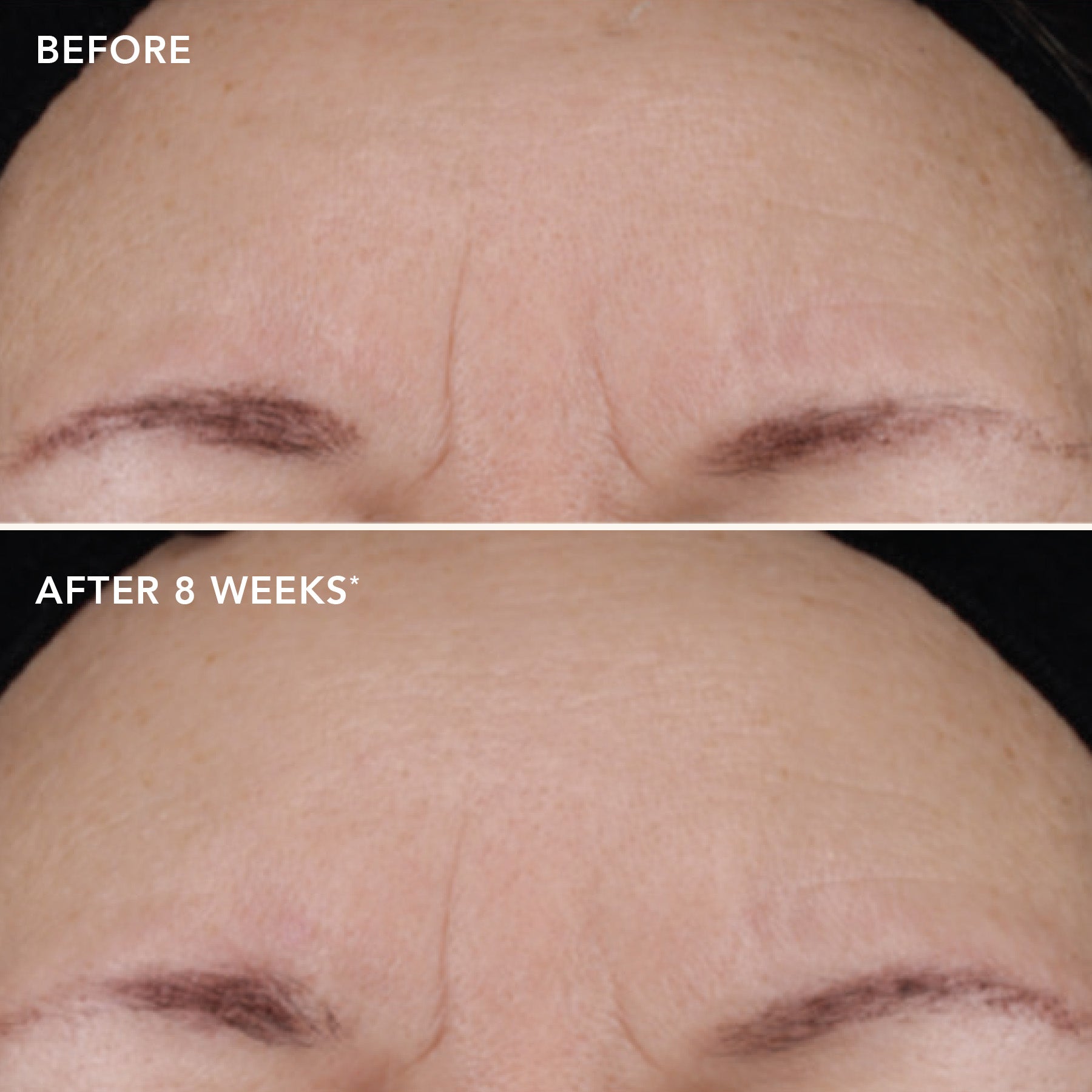 IMAGE AGELESS+ retinol treatment crème 1.2% retinol complex