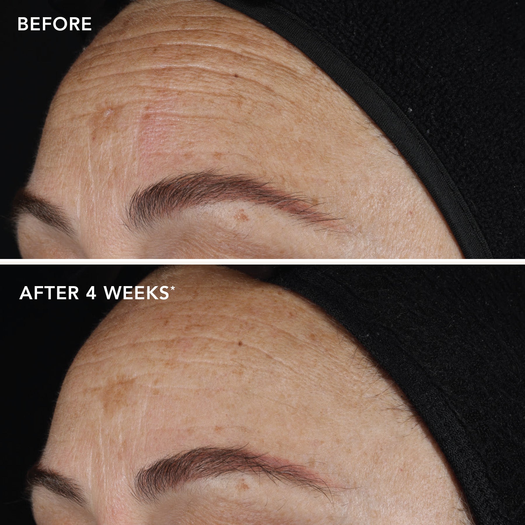 IMAGE AGELESS+ retinol pure liquid retinol 0.1%