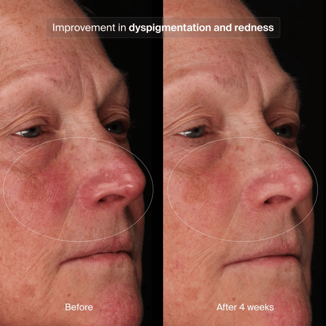Pavise Bioadaptive Stress Repair Serum Refill