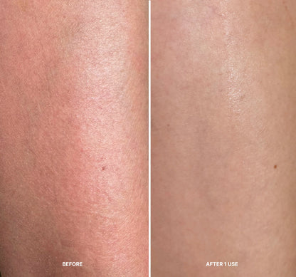 LILIS Instant Peel
