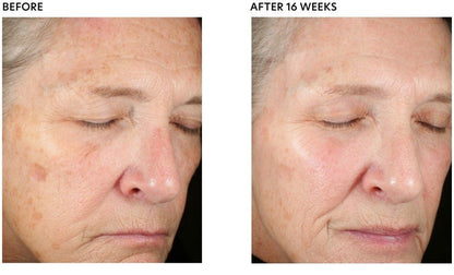 PCA Skin Pigment Gel® Pro