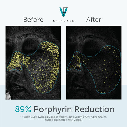 FactorFive Regenerative Serum