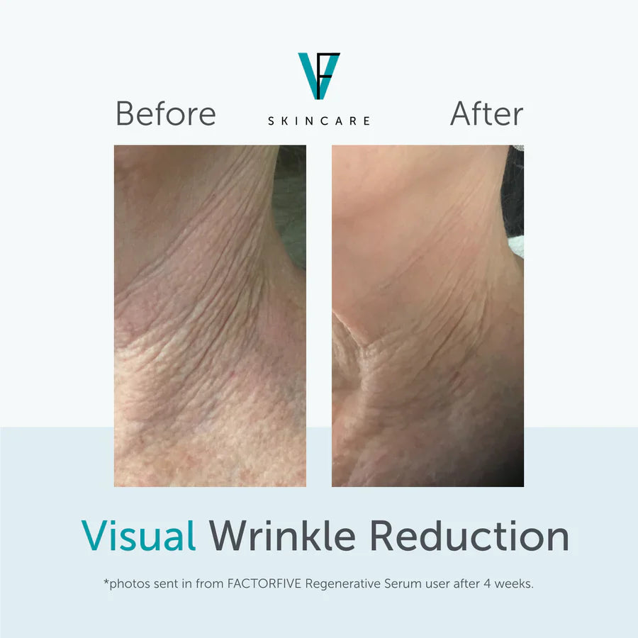 FactorFive Regenerative Serum