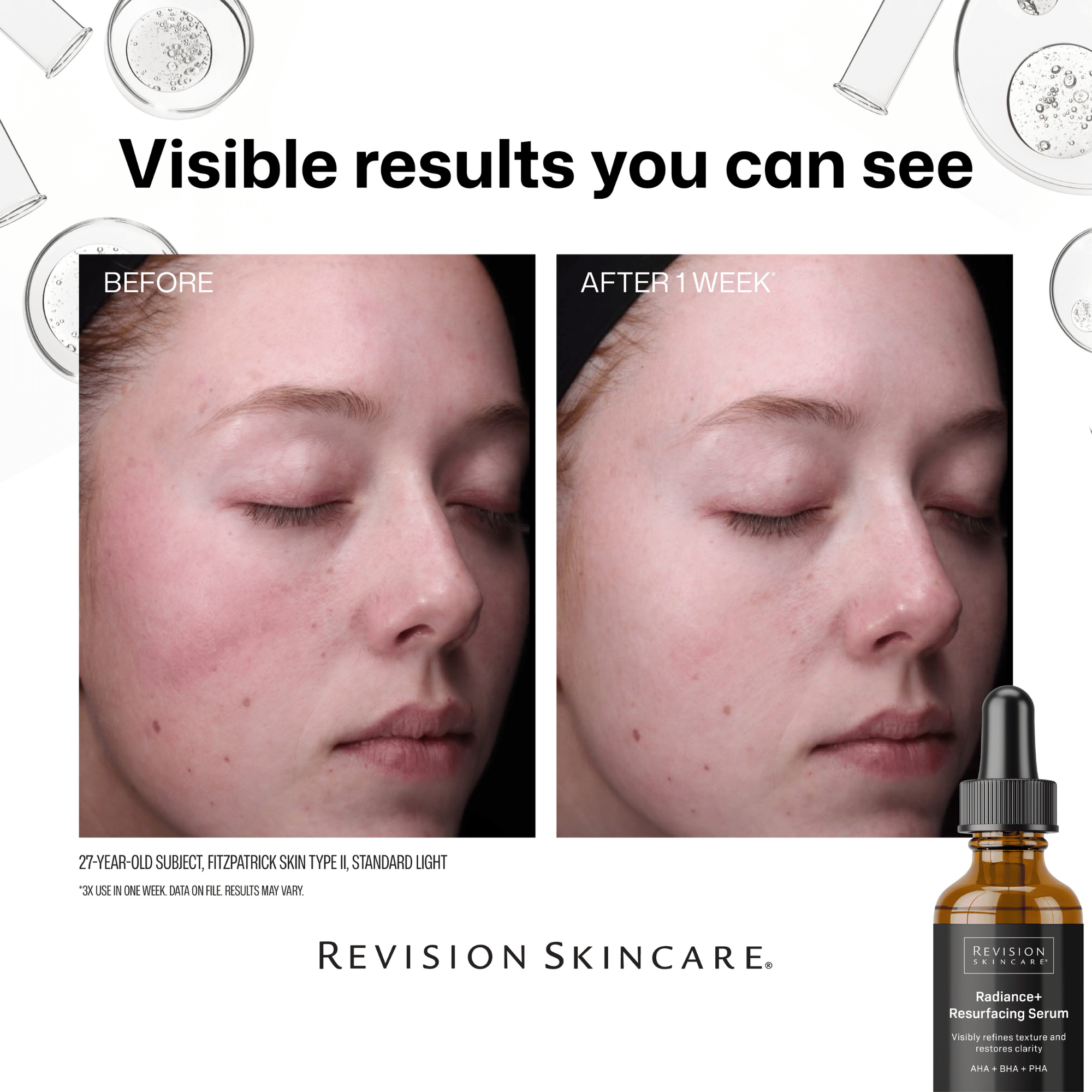 Revision Skincare Radiance+ Resurfacing Serum