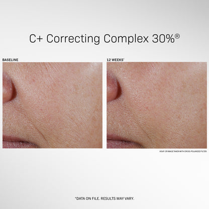 Revision® C+ Correcting Complex 30%® (travel size) -.5 fl oz.