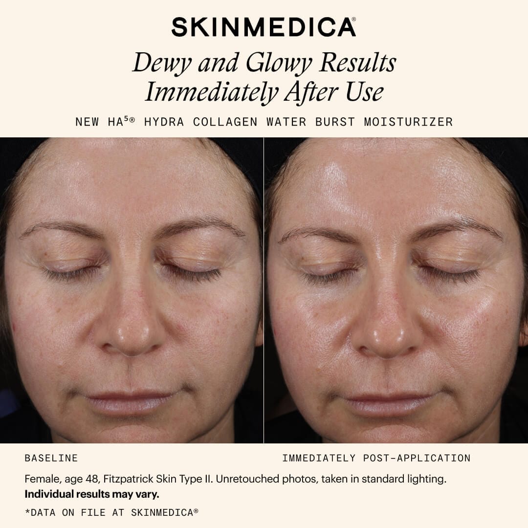SkinMedica HA5 Hydra Collagen Water Burst Moisturizer with Vegan Collagen