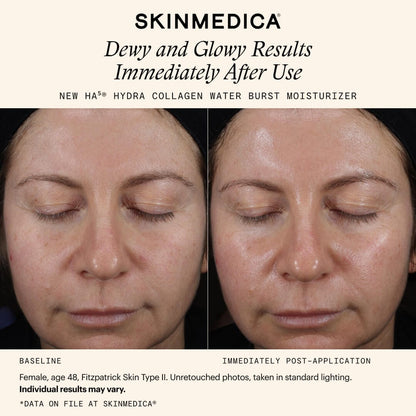 SkinMedica HA5 Hydra Collagen Water Burst Moisturizer with Vegan Collagen