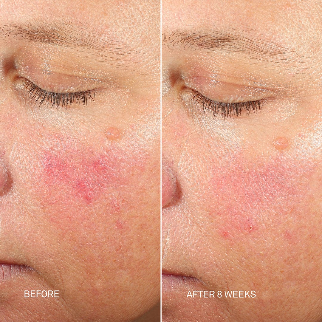 RescueMD Skin Longevity Nighttime Oil