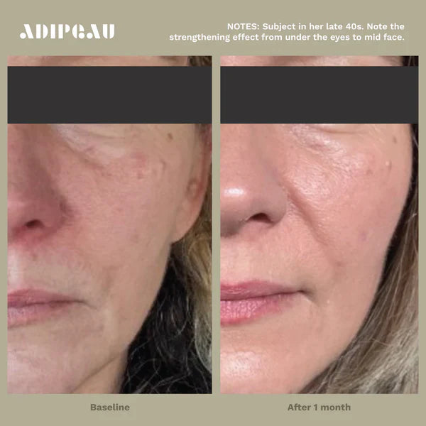Adipeau Strength Gel